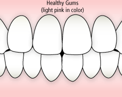 healthy gums